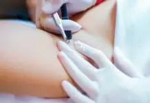 Особенности электроэпиляции