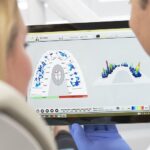 Что такое диагностика окклюзии и зачем она нужна