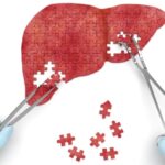 Восстановление печени