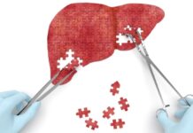 Восстановление печени