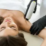 Лазерная эпиляция рук: навсегда избавиться от нежелательных волос