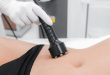 RF-лифтинг живота