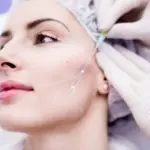 Нити для лица и тела Luxeface & Luxebody: тонкий мостик между красотой и естественностью