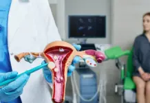 Современные методы лечения рака матки