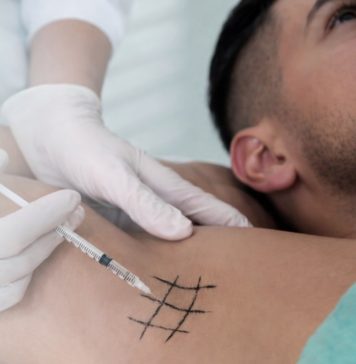 Эффект от лазерного лечения гипергидроза